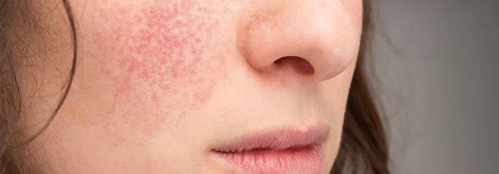 冬季干燥，溫濕度傳感器如何幫助我們調(diào)整室內(nèi)濕度？